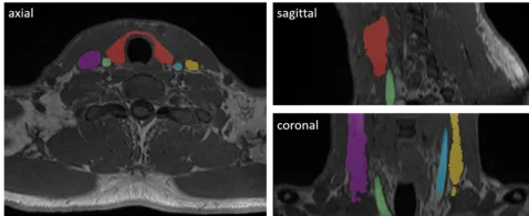 MRI example with multiple labels